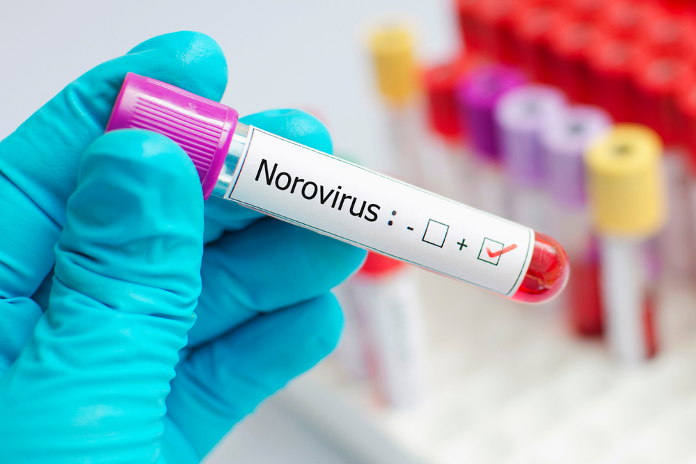 New study reveals a genotype responsible for most dangerous norovirus