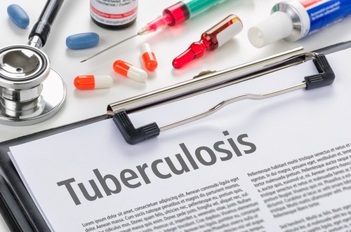 niaid strategic plan for tuberculosis research